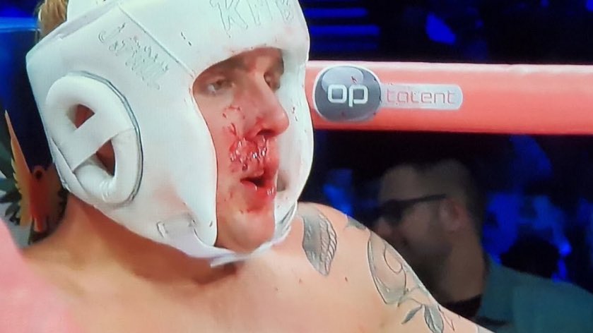UTDRA__'s tweet photo. @BleacherReport @ringmagazine The last time Jake Paul fought a tank: https://t.co/k1GrpYkdXK