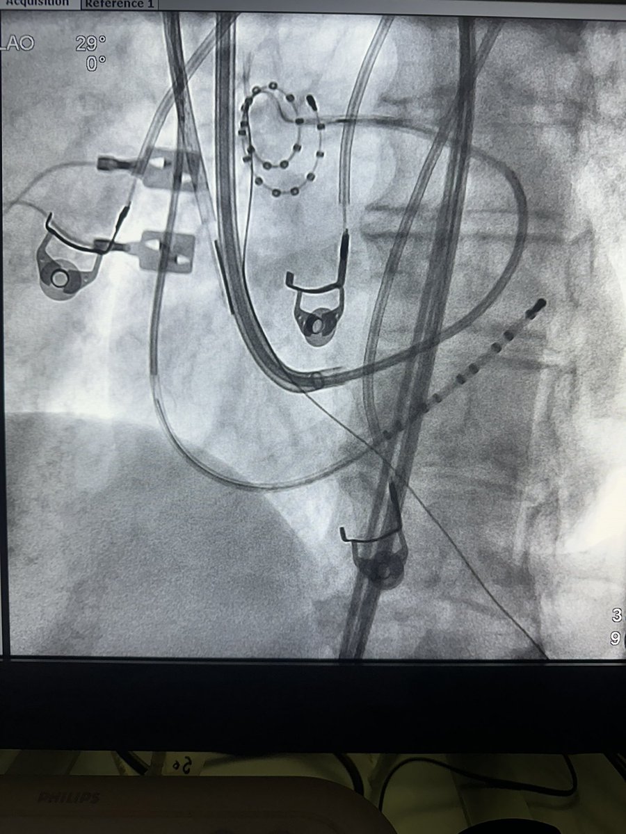 Fabricio Vassallo, MD, PhD tweet media