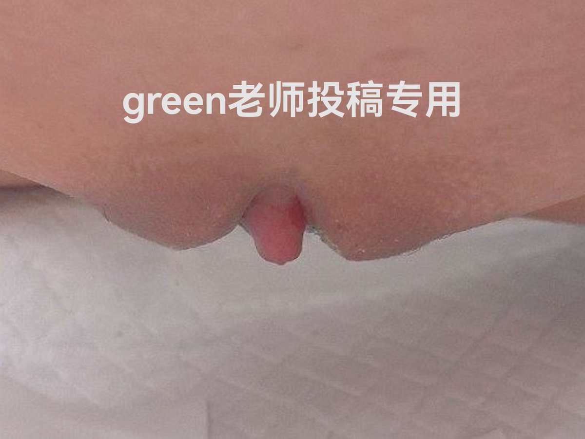Green老师的分身 tweet media
