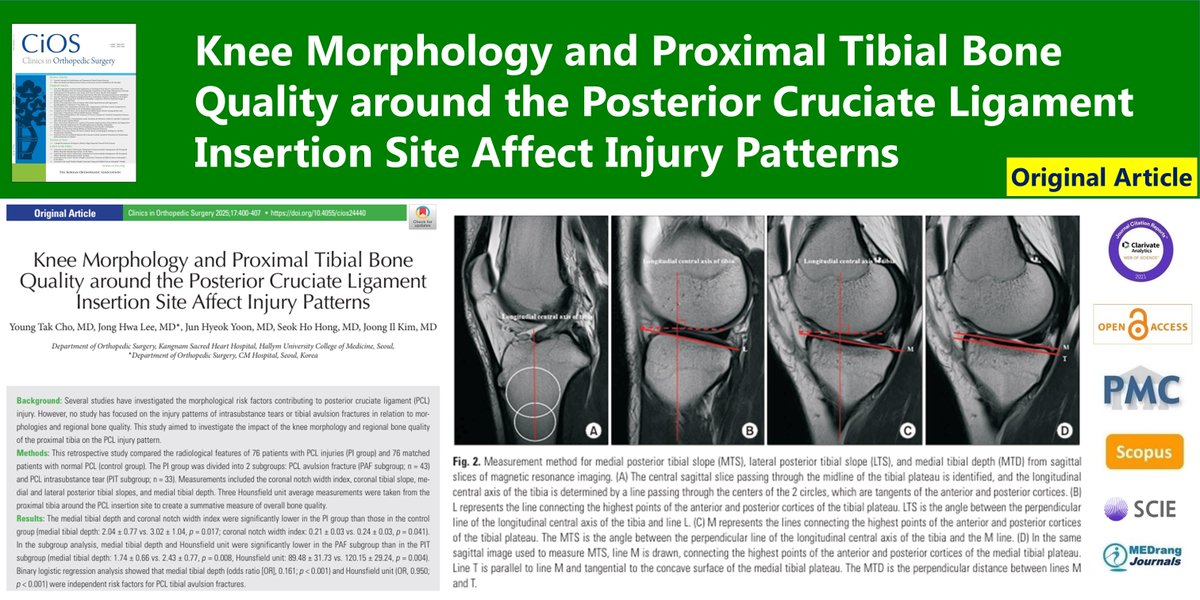 CiOSjournal's tweet image. Knee Morphology and Proximal Tibial Bone Quality around the Posterior Cruciate Ligament Insertion Site Affect Injury Patterns
🌷doi.org/10.4055/cios24…
2025 Jun;17(3) Young Tak Cho
#Posterior_cruciate_ligament #Avulsion_fracture #Morphological_factor #Bone_density