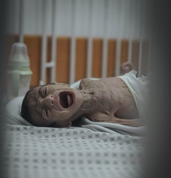 وای بر این مسلمانی ما....💔

#اللهم_عجل_لولیك_الفرج
#غزه_تموت_جوعاً
