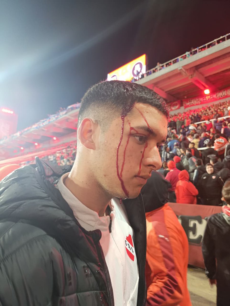 ASÍ quedó un hincha de #Independiente por las cosas que le tiraron desde la tribuna Pavoni Alta los hinchas de U de Chile.