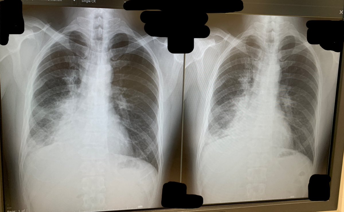 余命数日と医師から伝えられました

実は去年の夏頃から肺がんステージ4と診断されて闘病生活を送っていました
3種類程の治療を続けてきましたが効果のある期間が短く、癌の進行が早いので思った以上に最期の時が近くなってしまいました