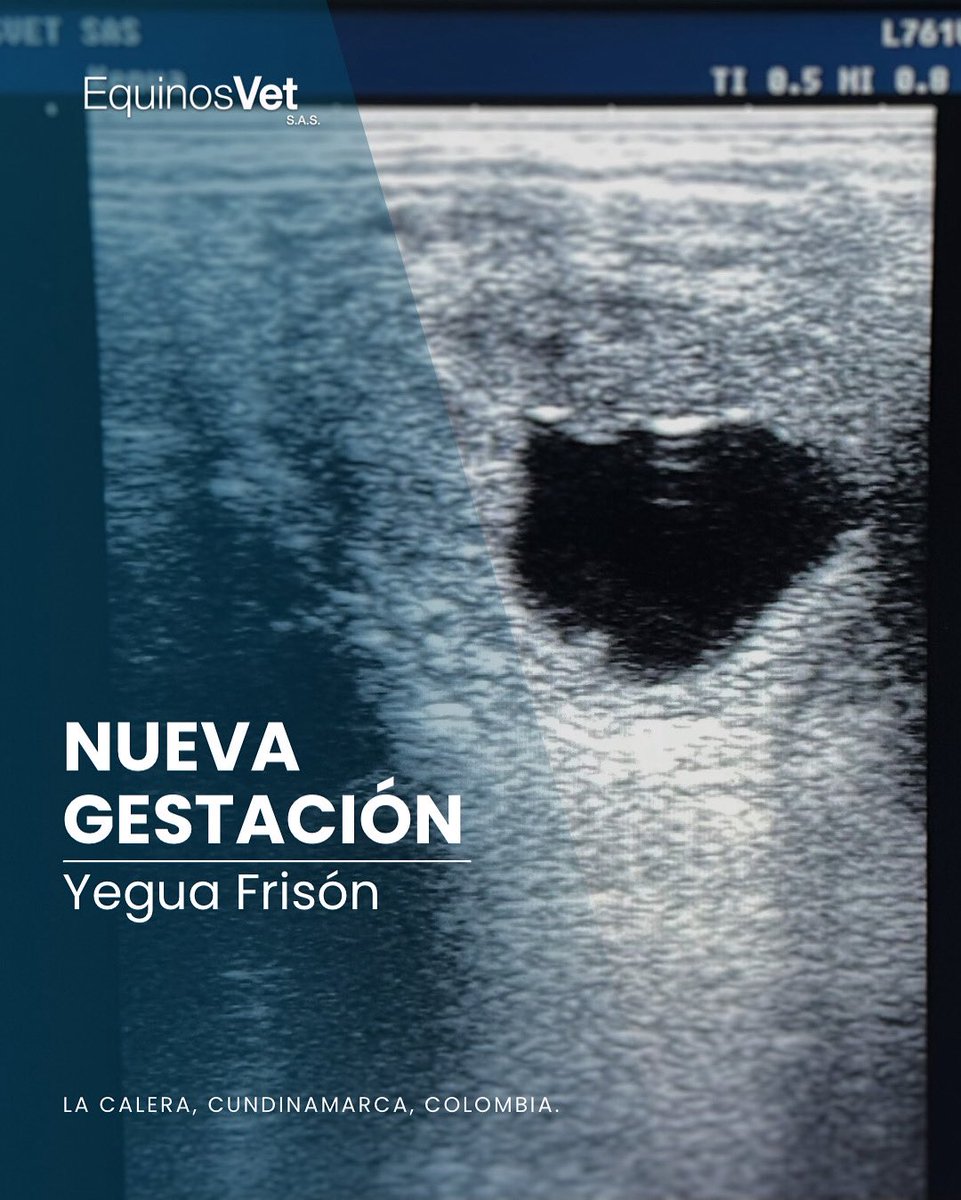 🐎 ¡Confirmado! Una nueva cría viene en camino.

🙏 Gracias al propietario por confiar en nuestro trabajo y permitirnos acompañarlo en este viaje.

❤️ ¡Seguiremos monitoreando esta gestación con todo el cuidado y compromiso que merece!
 
#EcografíaEquina