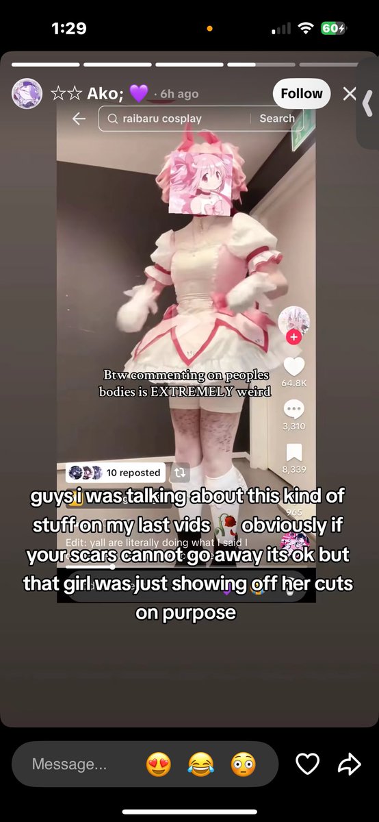 yumestinks's tweet photo. @toyasprincess greasy  ass 
also  it  makes  me  so  fucking  mad  whenn  people  say  shit  like
" they  did  it  on  purpose  ! "
HOW  DO  YOU  KNOW ..
also  they  found  ur  tweet  lolol https://t.co/YdepiSXse2