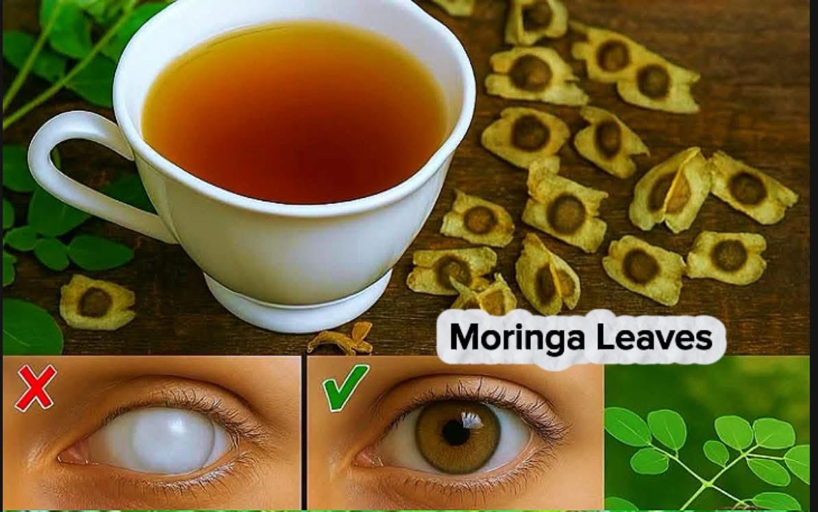 Are you suffering eye cataracts?

Don’t worry this miracle remedy improve your eye vision.

Take 1 tbs moringa seeds powder boil in 100 ml water. Strain and sip warm twice daily.