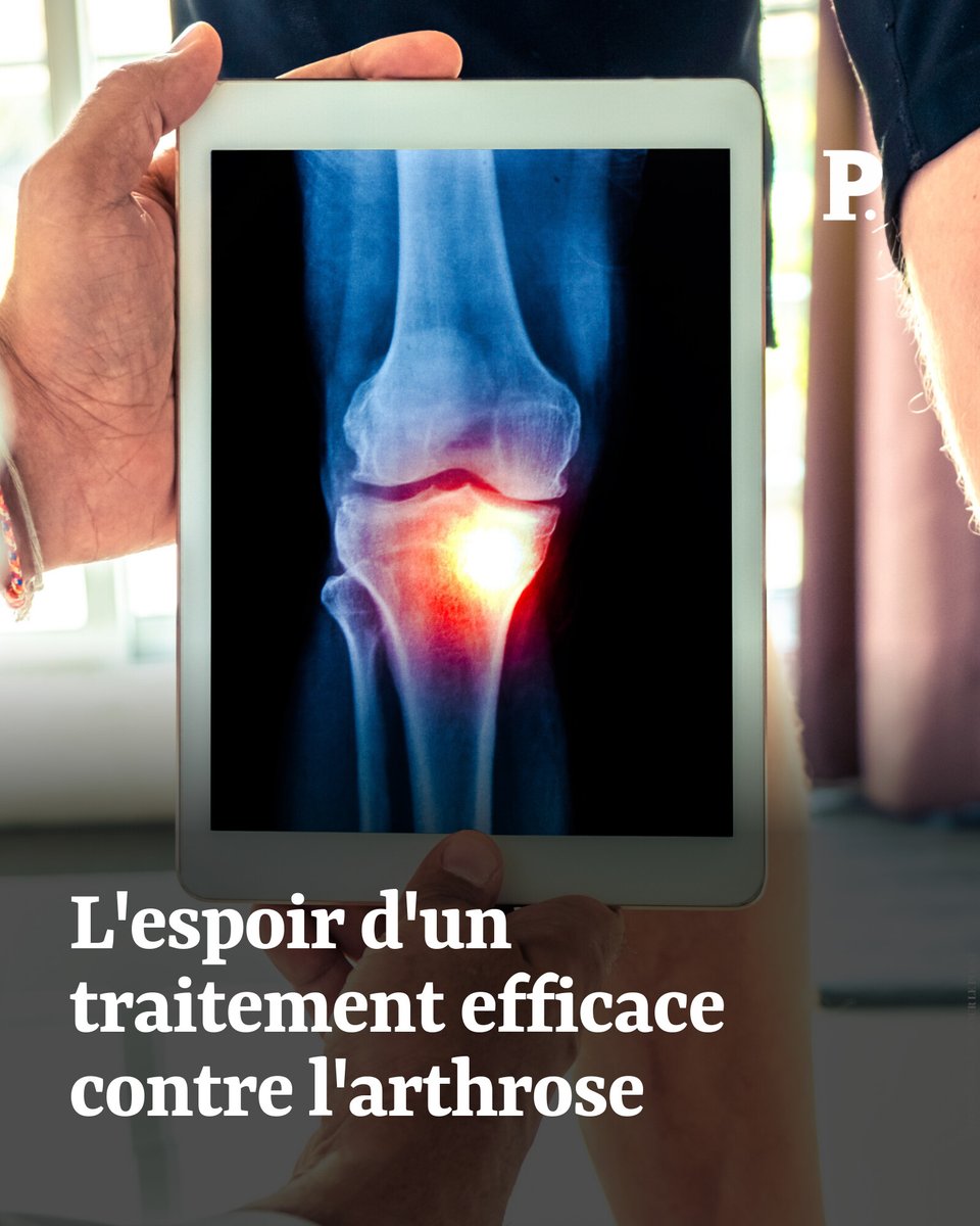 Le GLP-1 va-t-il révolutionner le traitement de l'arthrose ?

Par <a href="/OlivierHertel/">Olivier Hertel</a> ➡️ l.lepoint.fr/7JV