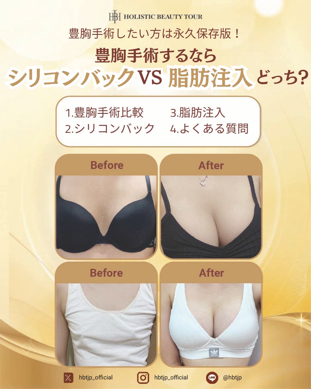 EVERA　韓国　美容　豊胸　美容整形　エベラ EVERA 韓国 美容 豊胸 美容整形 エベラ