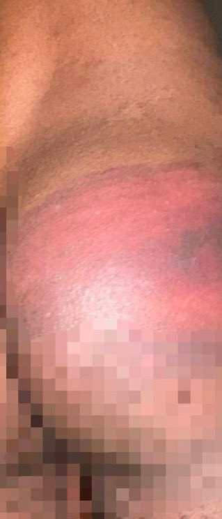 Vauh AYAMI brisé pour un crime inexistant : voilà la vraie barbarie d’État sous le régime <a href="/oliguinguema/">Brice Clotaire Oligui Nguema</a> 
#Gabon