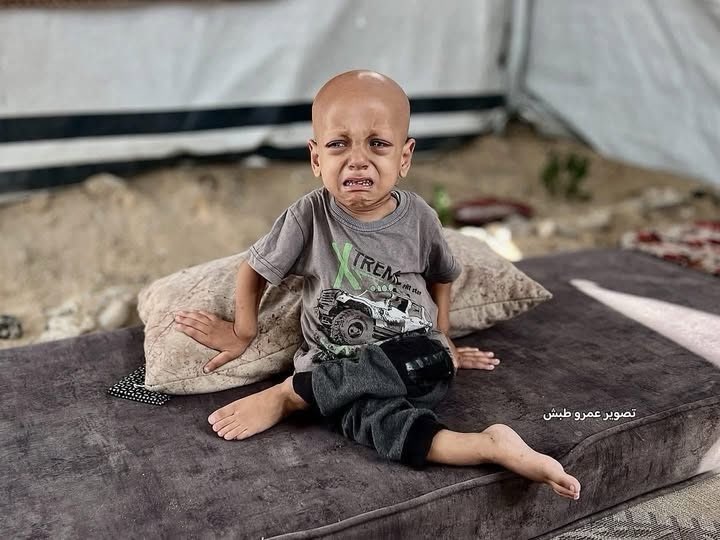AliciaCastroAR's tweet photo. I “No Quiero Morir de Hambre” — Y Lo Dejó Diciendo
Abdullah Abu Zarqa, el niño palestino de Gaza que hace un mes rompió corazones diciendo: “Tengo hambre”, acaba de morir en un hospital de Turquía.
Tenía solo 5 años. Su frágil cuerpo no resistió las secuelas de la desnutrición severa provocada por el cerco israelí, ni el retraso criminal de su traslado para recibir tratamiento, obstruido por la ocupación.
Su rostro se convirtió en símbolo de una infancia marcada por el hambre y el abandono. Hoy, su muerte confirma lo que ya sabíamos: Israel está dejando morir de hambre a los niños de Gaza. Sin excusas, sin piedad.