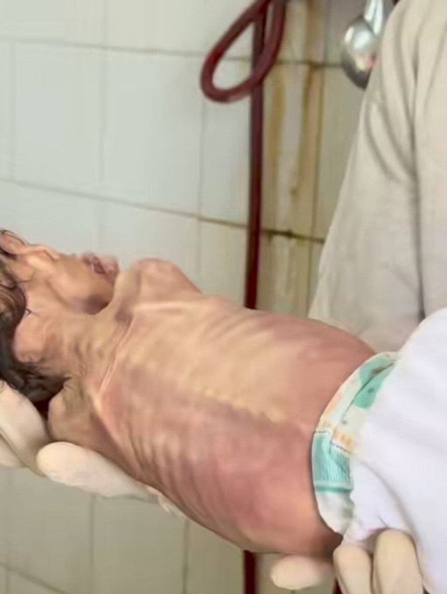 "Israeli war crimes"

Where are the human rights organizations?
Where is the hypocritical international law?
Why the double standards?
Why does the world — especially the West — remain silent when Israel is the criminal?
Why does America, which claims to stand for human rights,