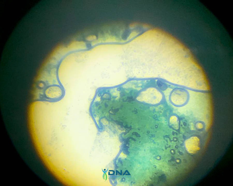 DNALCNigeria's tweet image. BioInnovation Project Group Discussion, where world-changing ideas are brewing!

Day 9 is ON FIRE, and we’re making HISTORY!

#DNALCN #SummerCourse2025 #BioInnovation #ScienceRevolution #dnalcnigeria