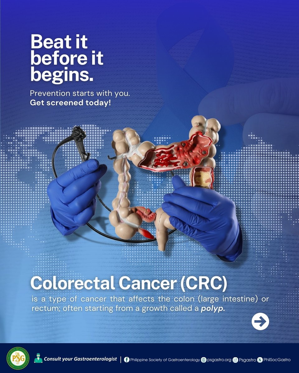 PhilSocGastro's tweet photo. Learn more about Colorectal cancer and its risk factors — take charge of your health today!  

Please follow, like, and share   

#PhilippineSocietyOfGastroenterology #PSG #PSGCares #PSGNutritionCouncil #HealthAdvisory #PSG #PhilippineSocietyOfGastroenterology https://t.co/8bGCuOdMrj