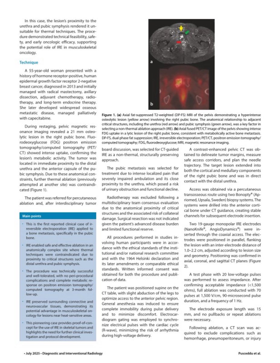 Interventional Oncology Institute tweet media