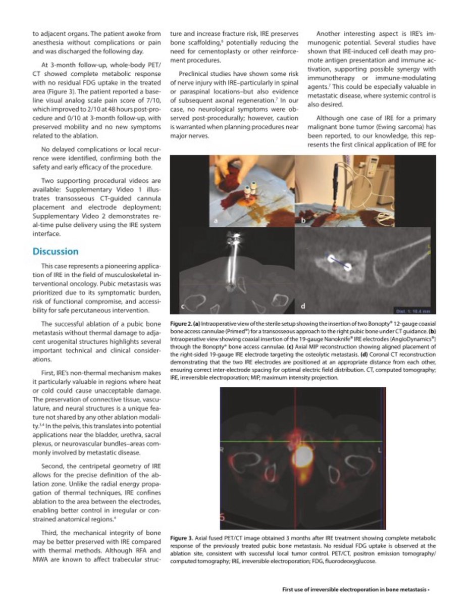 Interventional Oncology Institute tweet media
