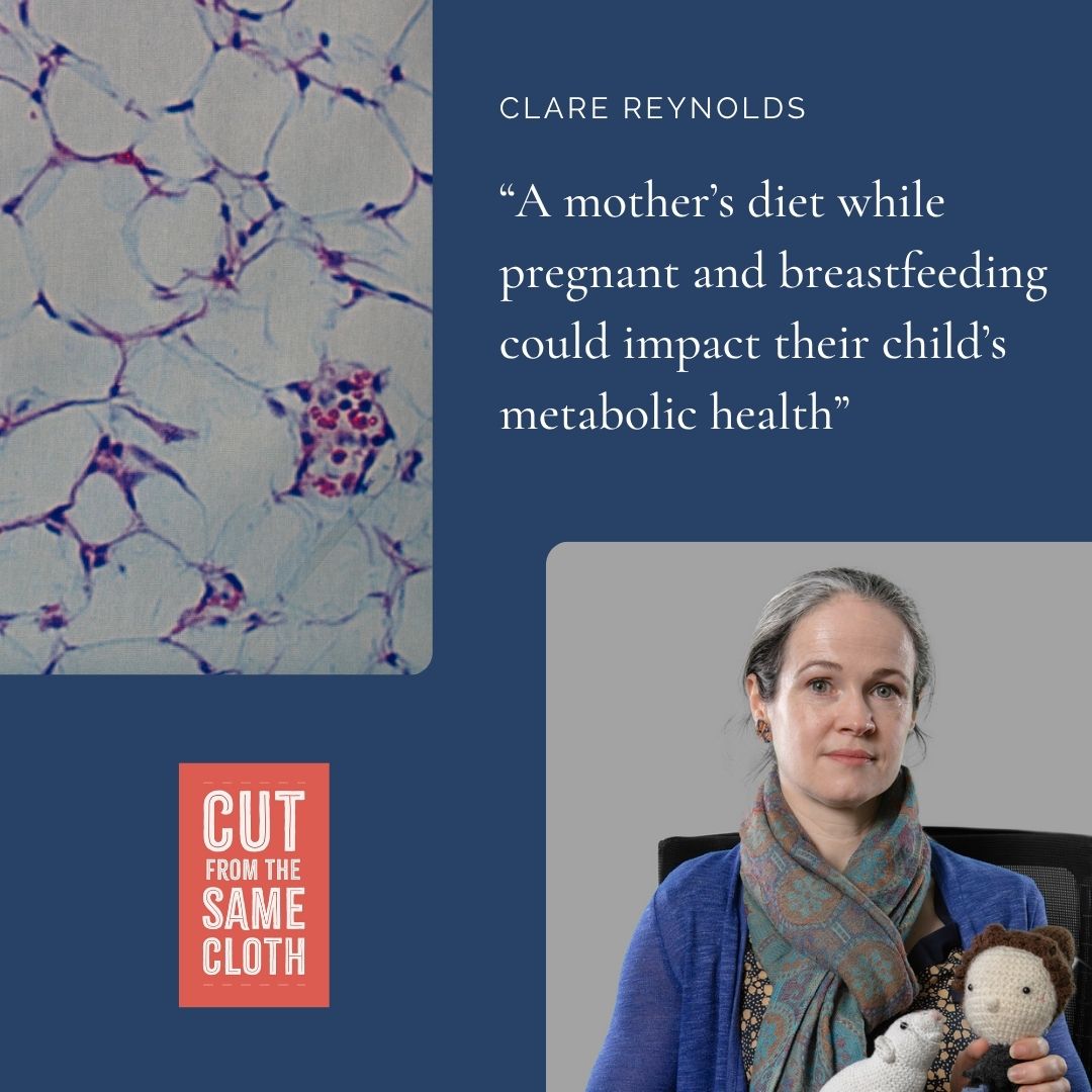 UCD_Conway's tweet image. Prof. Clare Reynolds’ fabric shows enlarged fat cells linked to maternal diet and kids’ metabolic health. Inspired by this, she’d love to turn it into a dress. #CutFromTheSameCloth