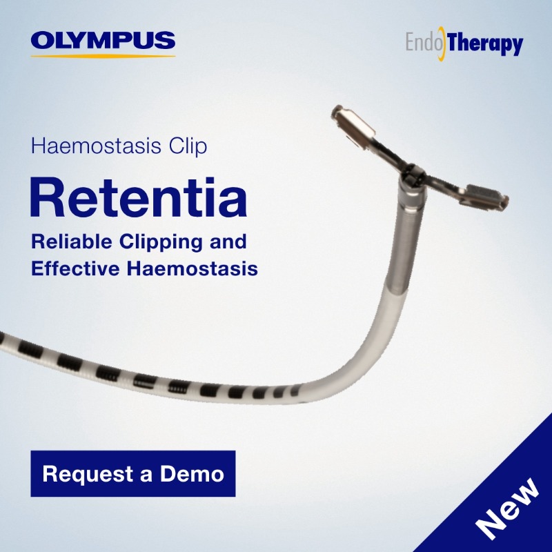 OlympusMedUKIE's tweet photo. Introducing #RETENTIA
The new #haemostasis clip from Olympus offering:
↕️ Tail lengths as small as 5.7mm
↔️ 3 closing widths - 9mm, 12mm & 16mm
↩️ Reliable performance through angulated scope positions
Discover more & request a demo: https://t.co/NGElaOkSd1
#BleedingManagement