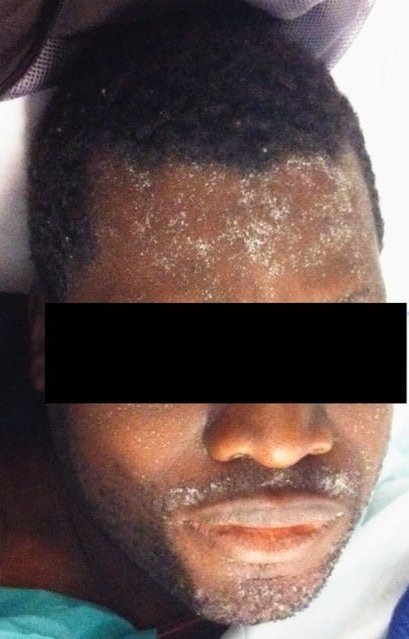 IhabFathiSulima's tweet photo. What is the description or diagnosis? https://t.co/XAmN8RTIbr