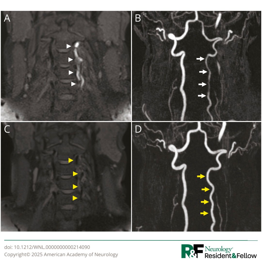 Neurology Journal tweet media