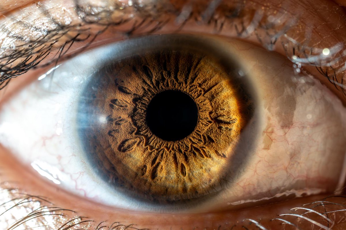 🚨 New &amp; updated Clinical Management Guidelines (CMGs)

➕ NEW: Pseudophakic cystoid macular oedema (PCMO)
✅ Updated: Herpes simplex keratitis
✅ Updated: Herpes zoster ophthalmicus

Members can view the latest guidance on our site or College Member App➡️ coptom.uk/CMGs