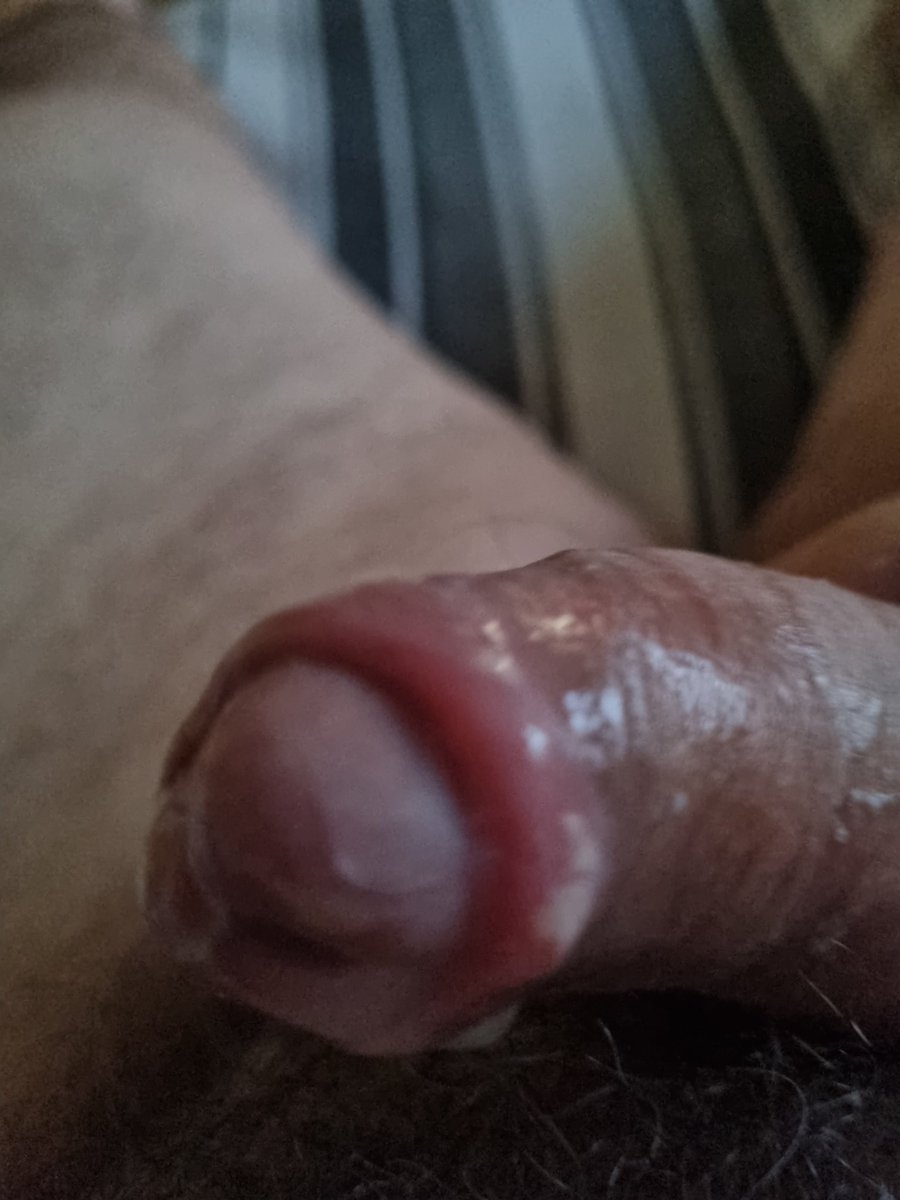 Pica inchada e esfolada de tanta punheta, cada dia mais viciado 🤪🤪