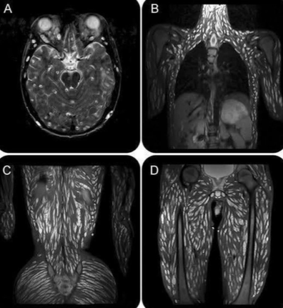 MorbidKnowledge's tweet photo. Medical scans show an 18-year-old boy infected with parasites. https://t.co/OQysRYYfQE