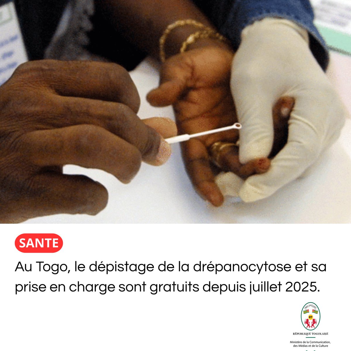 #Santé
#LeTogoAujourdhui

Au #Togo🇹🇬✨ le dépistage de la drepanocytose et sa prise en charge sont gratuits depuis juillet 2025.
