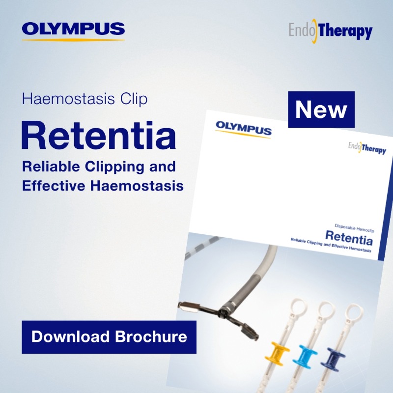 OlympusMedUKIE's tweet photo. Introducing #RETENTIA
The new #haemostasis clip from Olympus
The Retentia Clip is crafted from durable, high-strength stainless steel to support reliable closure and haemostasis, with our smallest tail just 5.4mm long
Find out more: https://t.co/teURh1KTd9
#BleedingManagement