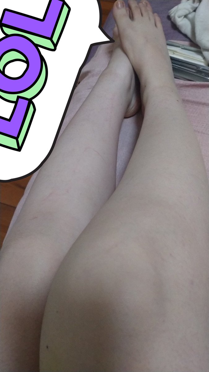 媒体预览