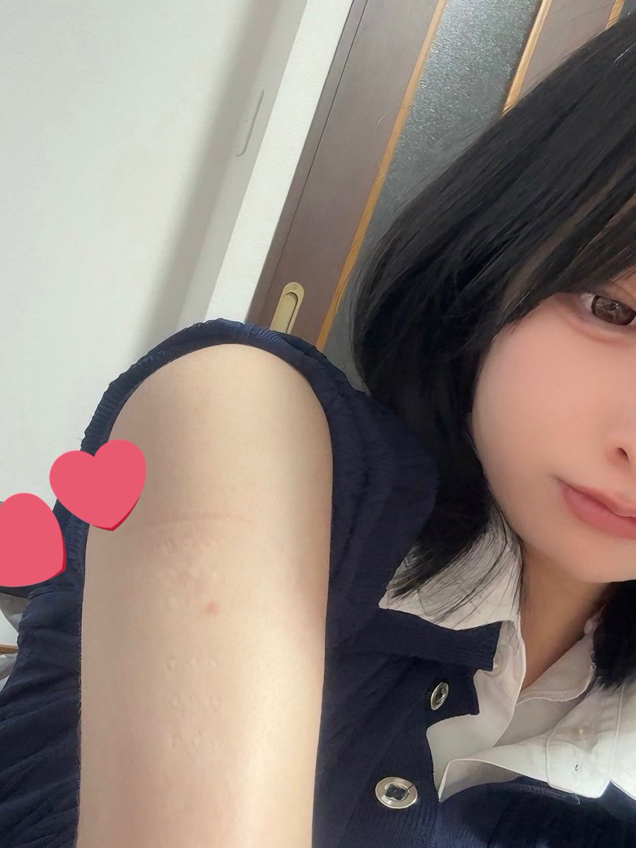 この中に
はんこ注射フェチのひといませんか❣️❣️

きぃあんまり見ないレベルではんこ注射の跡が消えないんです❣️❣️❣️❣️