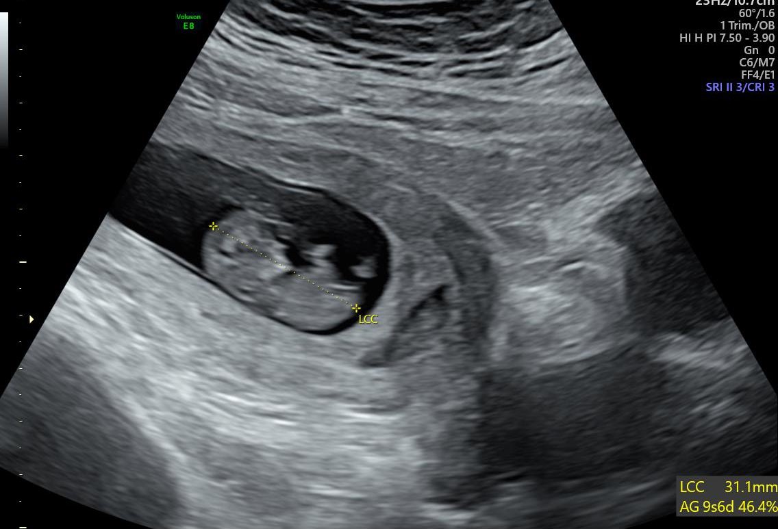 Tania 🌈 🌸 tweet media