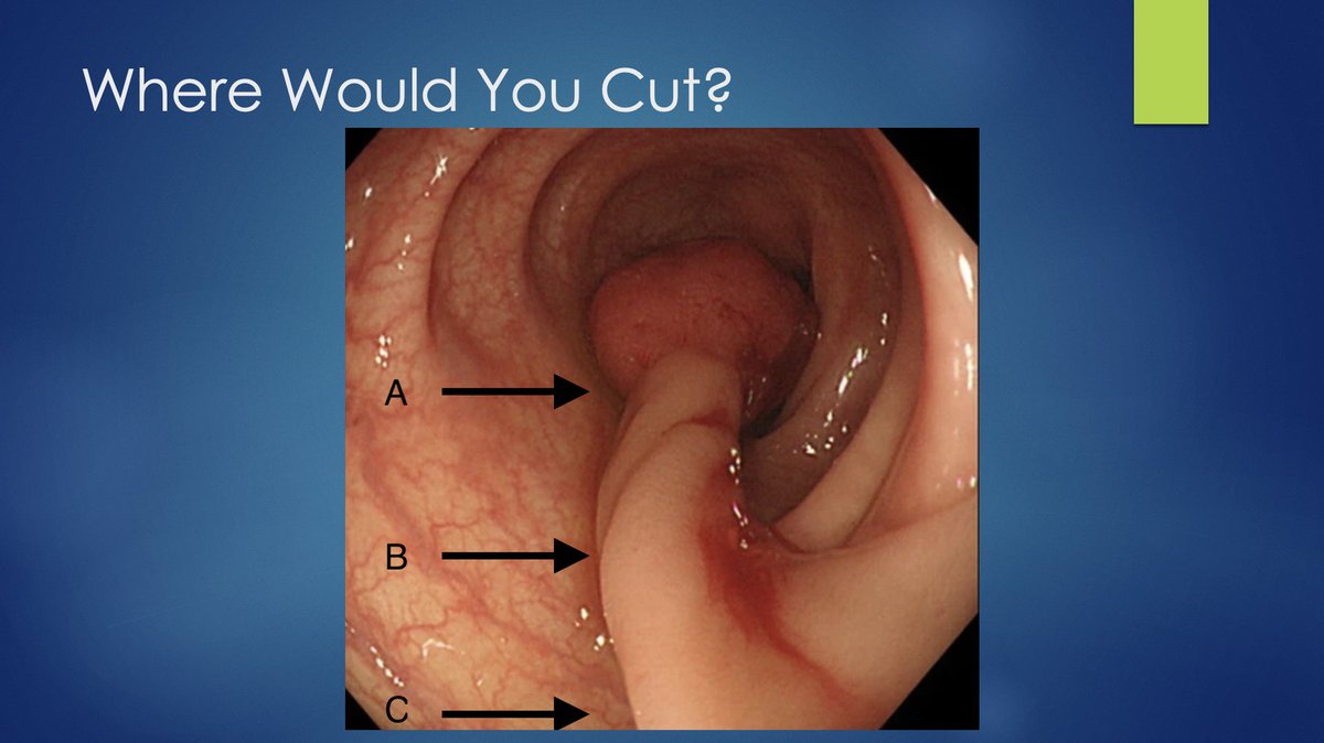 Tom Tielleman, MD tweet media