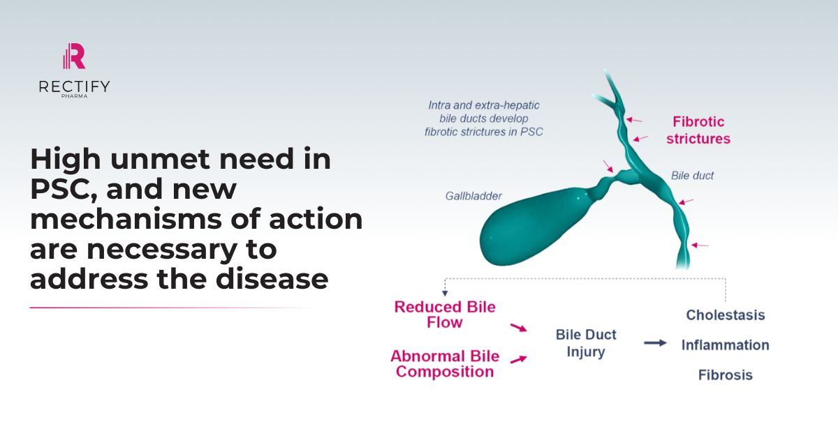 RectifyPharma's tweet image. #PrimarySclerosingCholangitis is a #RareLiverDisease that scars bile ducts & raises the risk of #BileDuctCancer. Often diagnosed late, it’s among the most aggressive cancers. We’re working to address PSC’s core pathophysiology & improve outcomes. More here:mayocl.in/3RI5oXW