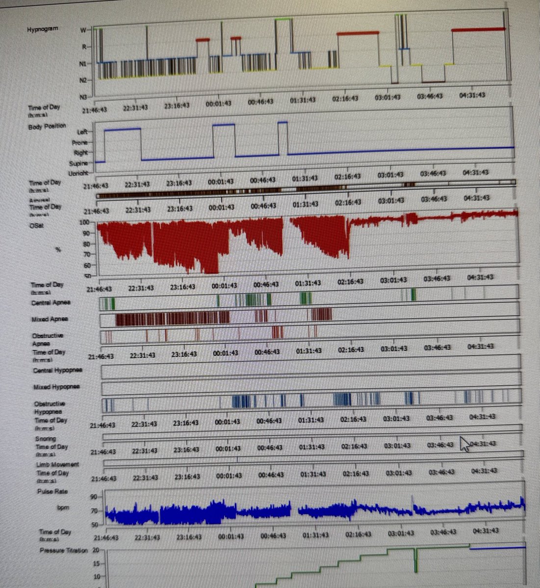 Sleep Vigilante MD, MPH, FAASM tweet media