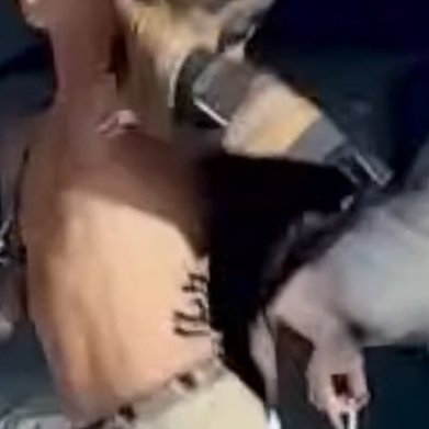 Changkyun performing while having his back all taped up and under immense pain ㅠㅠㅠ we don’t deserve him