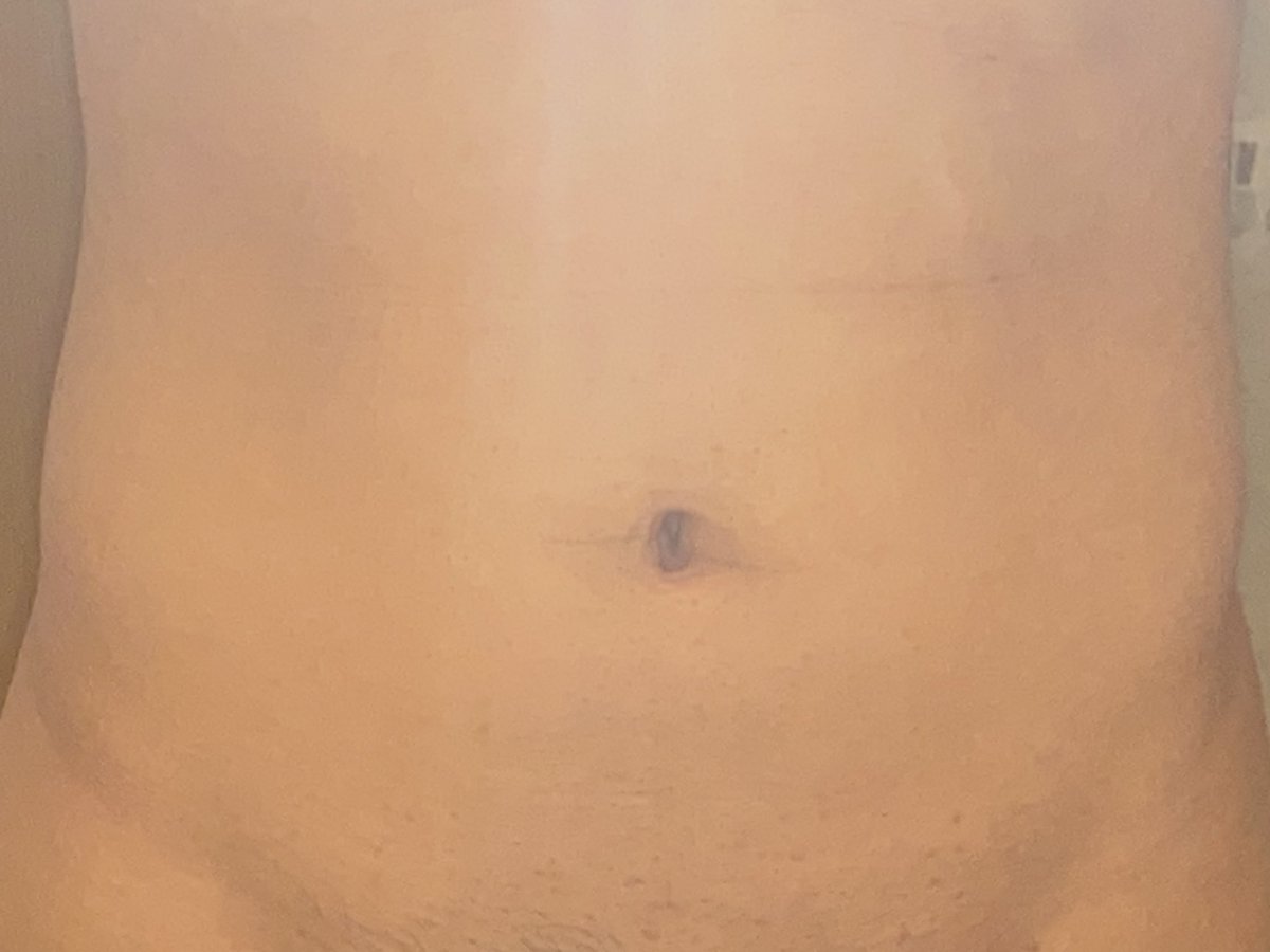 sta12019's tweet photo. 最近稍微胖了点，肚脐眼看起来比以前���圆更深了（当然，也不排除是自己用手指、唇膏、改锥之类的捅多了😄）

觉得自己的脐口好骚，门户洞开来者不拒的样子

稍微清理下毛发，脐底的纹路就清晰可见了 https://t.co/0LXvxR0jok