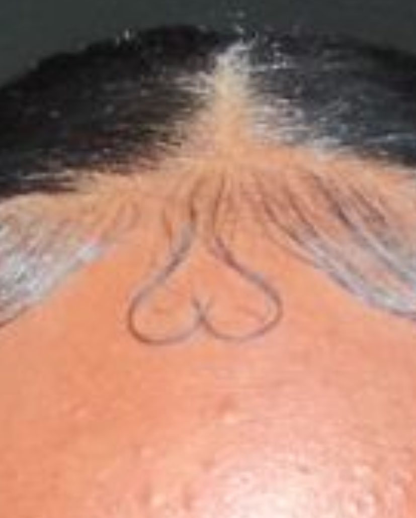 lemes_fox's tweet photo. gente, só eu acho esses baby hair se parecem com as bola do saco ? Né possível trem feio https://t.co/V09w9XeUPF