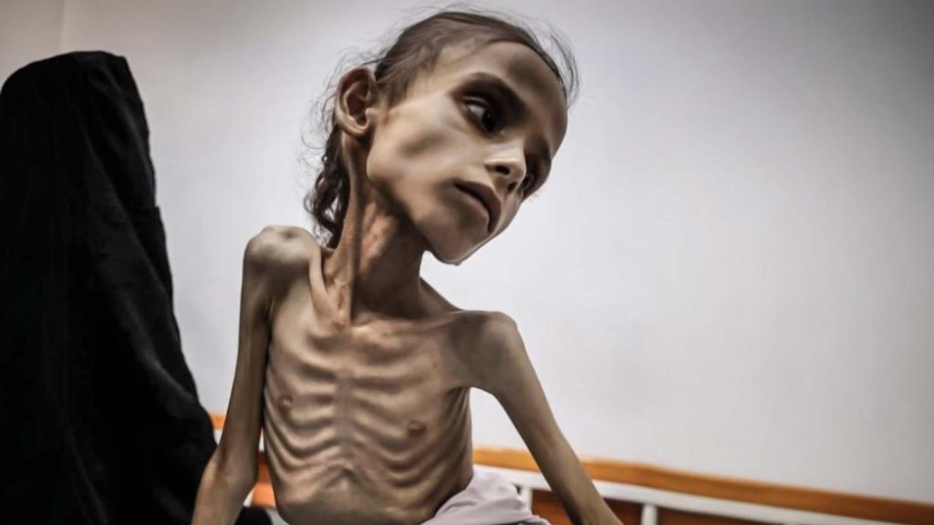 El hambre como arma de guerra de Israel. La desnutrición mata al pueblo palestino. <a href="/FEPDES/">FEPDES Nicaragua</a> <a href="/FesitunNi/">fesitun nicaragua</a> <a href="/Anden1979/">Anden-Nacional</a> <a href="/CTCPFNT/">Confederación De Trabajadores Por Cuenta Propia</a>