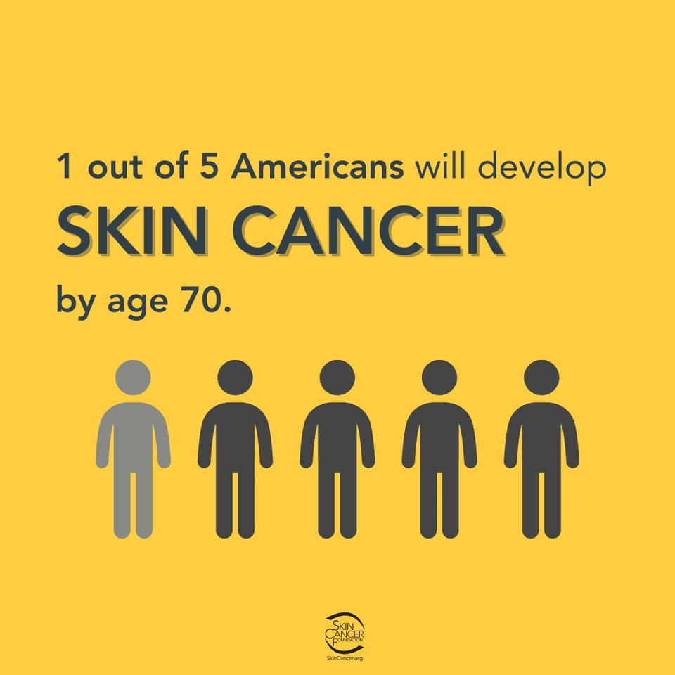 SkinCancerOrg's tweet image. Skin cancer is the most common cancer in the U.S., and that’s why it’s so important to protect your skin year-round! Early detection can save your life! skincancer.org/skin-cancer-in… #SkinCancerPrevention #SunSafety #EarlyDetection