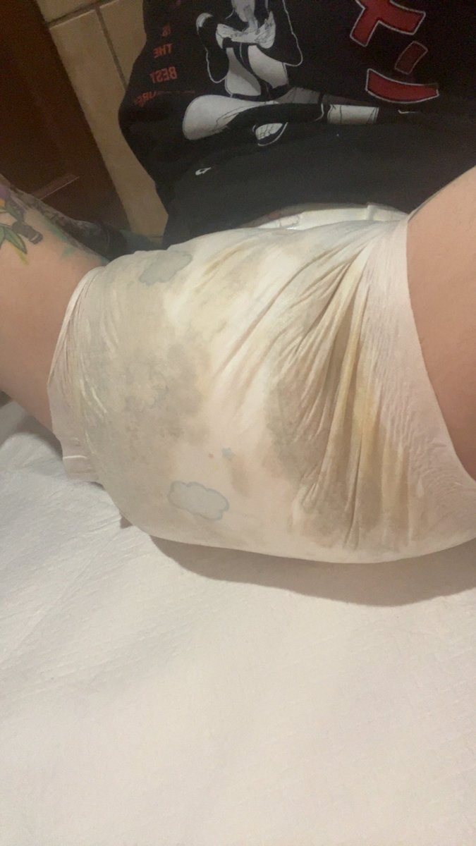 Last Stinky Before My Surgery 😢