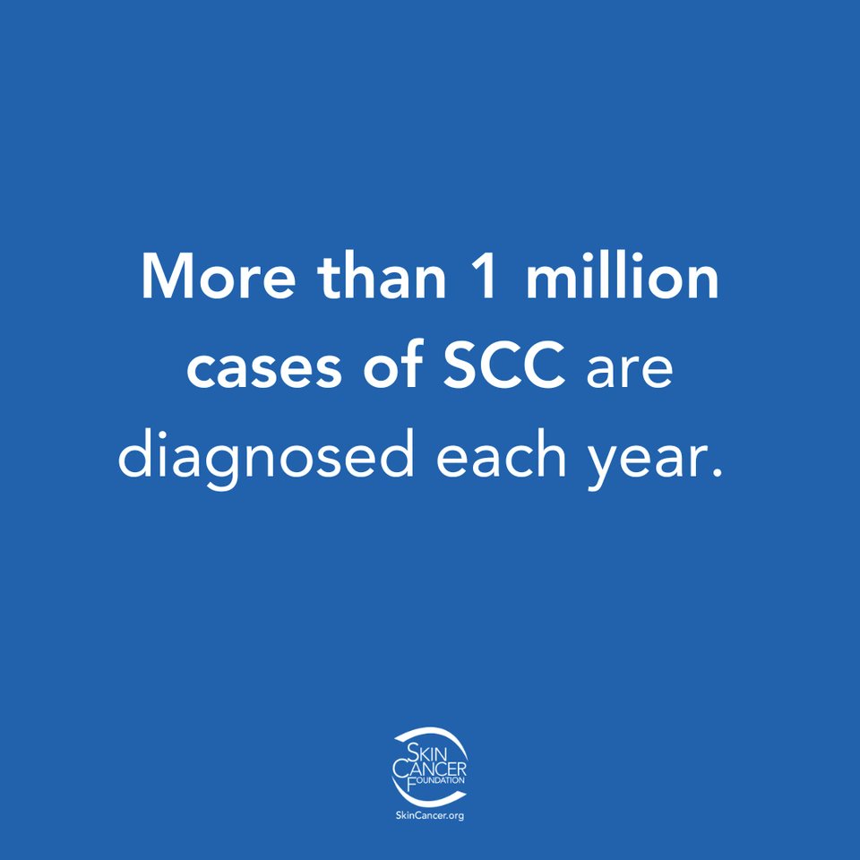 SkinCancerOrg's tweet image. Squamous cell carcinoma (SCC) is one of the most common forms of skin cancer, and early detection can make all the difference. Learn more about what to look for and how to protect yourself. Stay informed, stay protected! Learn more here #SkinCancerAwareness #SCC #SunSafety