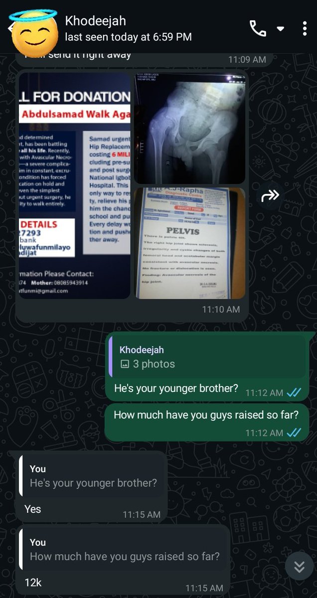 A CALL FOR HELP!!!🙏

The person with the account number on the picture was my classmate in school and her younger brother lives  with sickle cell disease.  He has been living with pain but now it has gotten critical.  The family is in need of a total of 6 million naira to