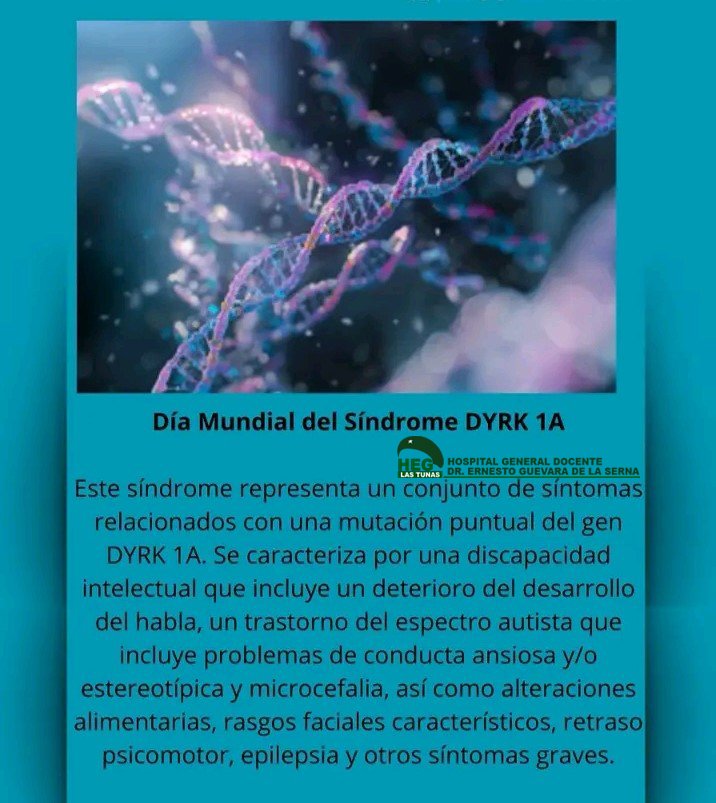 Hospital Guevara Tunas (@gladielisa86100) on Twitter photo 🔬🦠Si de enfermedades raras se trata el Síndrome DYRK 1A es calificado como muy raro; hoy se celebra el Día Mundial de esta enfermedad. Desde el #HospitalGuevara la información de salud 👇#CubaPorLaVida <a href="/gobiernotunas/">Gobierno Provincial de Las Tunas</a> <a href="/LorenzoOsbel/">Osbel Lorenzo</a> <a href="/DirGeneralTunas/">Director General de Salud Las Tunas</a> <a href="/ORSerranoB/">Orlando Rafael Serrano-Barrera</a> <a href="/LuisNoelPerezR2/">Luis Noel Pérez Rivero</a> 🔬🦠Si de enfermedades raras se trata el Síndrome DYRK 1A es calificado como muy raro; hoy se celebra el Día Mundial de esta enfermedad. Desde el #HospitalGuevara la información de salud 👇#CubaPorLaVida <a href="/gobiernotunas/">Gobierno Provincial de Las Tunas</a> <a href="/LorenzoOsbel/">Osbel Lorenzo</a> <a href="/DirGeneralTunas/">Director General de Salud Las Tunas</a> <a href="/ORSerranoB/">Orlando Rafael Serrano-Barrera</a> <a href="/LuisNoelPerezR2/">Luis Noel Pérez Rivero</a>