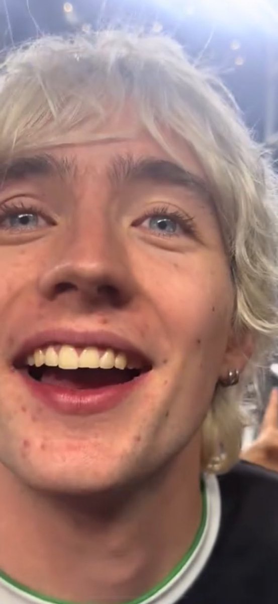 bellaskeetz's tweet image. why is he beautiful