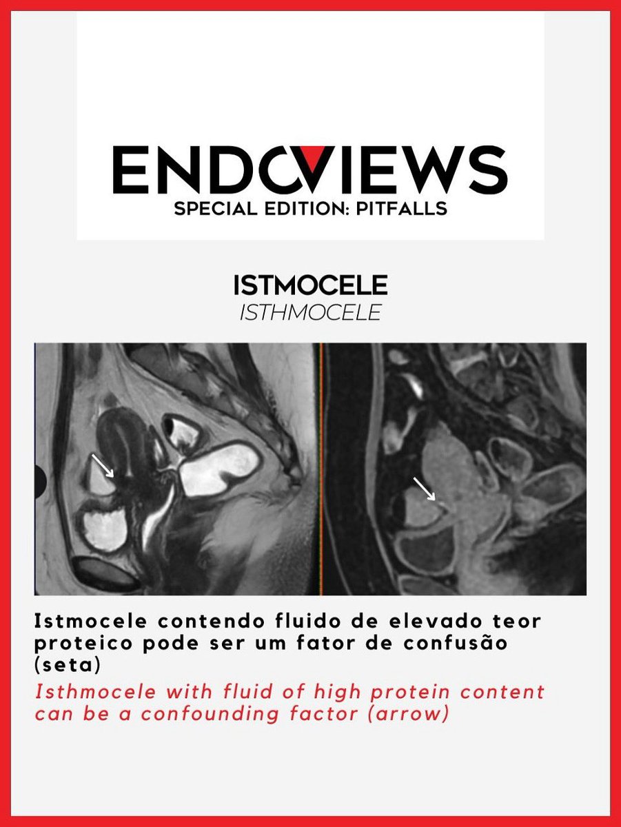 Endoviews tweet media