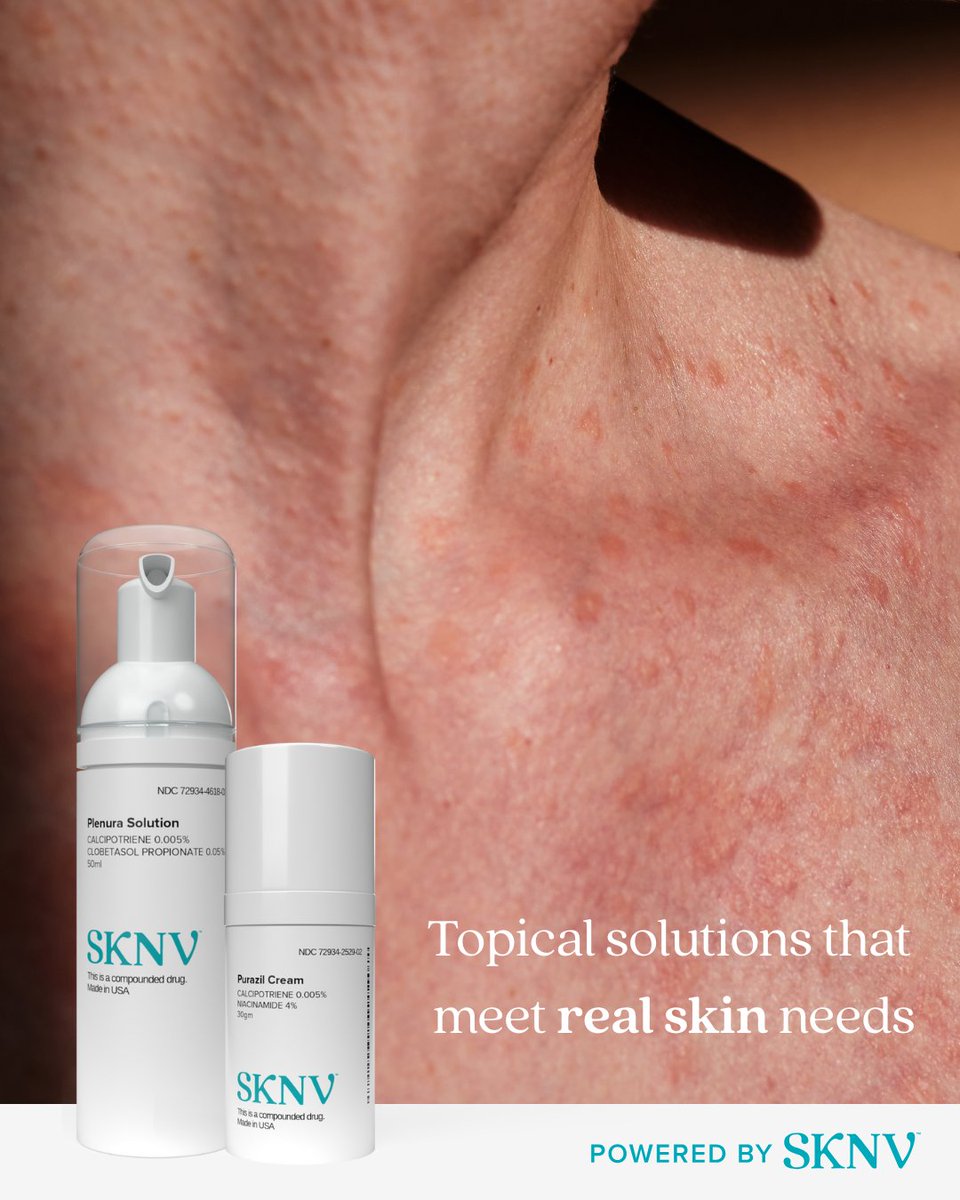 Psoriasis care starts with confidence in what you’re using. 💙

SKNV prescriptions are:
✔️ Made in the USA
✔️ Developed in a FDA-Registered 503B Outsourcing Facility
✔️ Affordable
✔️ Free from unnecessary ingredients that may irritate your skin

Ask your provider about #SKNV.