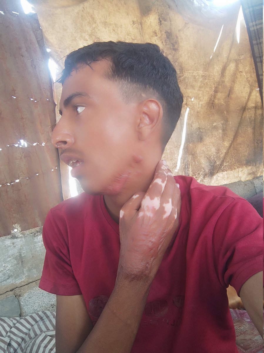 I'm not famous.
I'm not an actor, an artist, a head of state, or a player.
I'm just hungry 🥺 trying to escape Gaza 💔🇵🇸

If you're passing by, please leave a dot.

Let the world know that we're still alive 🕊️

🆘 If you can help, here's the donation link:
gofund.me/fc004994
