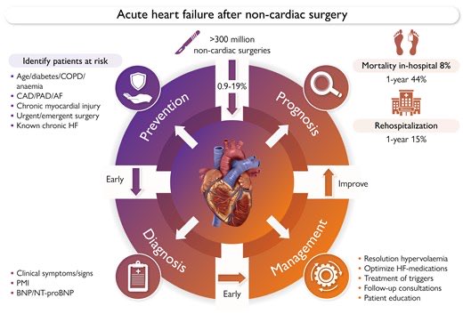 SeguraCardio's tweet photo. Acute HF after non-cardiac surgery: not rare, potentially challenging ⚠️
🚨 #ACVC/#HFA of the @escardio NEW CLINICAL consensus 📄
Useful for anaesthesiologists, ICU, cardiologists & more‼️
Share it ❤️
#CardioTwitter #Periop #NonCardiacSurgery #HF #HeartFailure https://t.co/RbPI1AQRUh