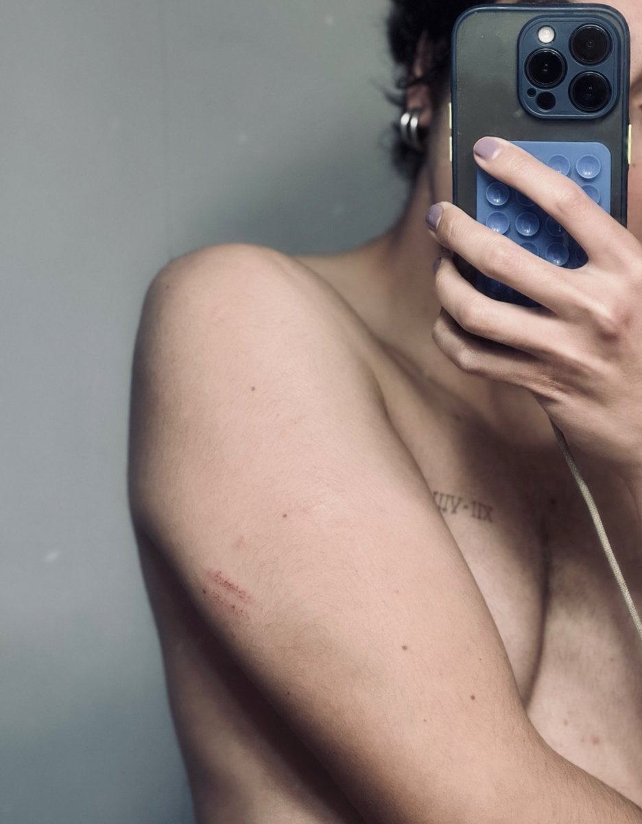 Auch! Me rasmillé