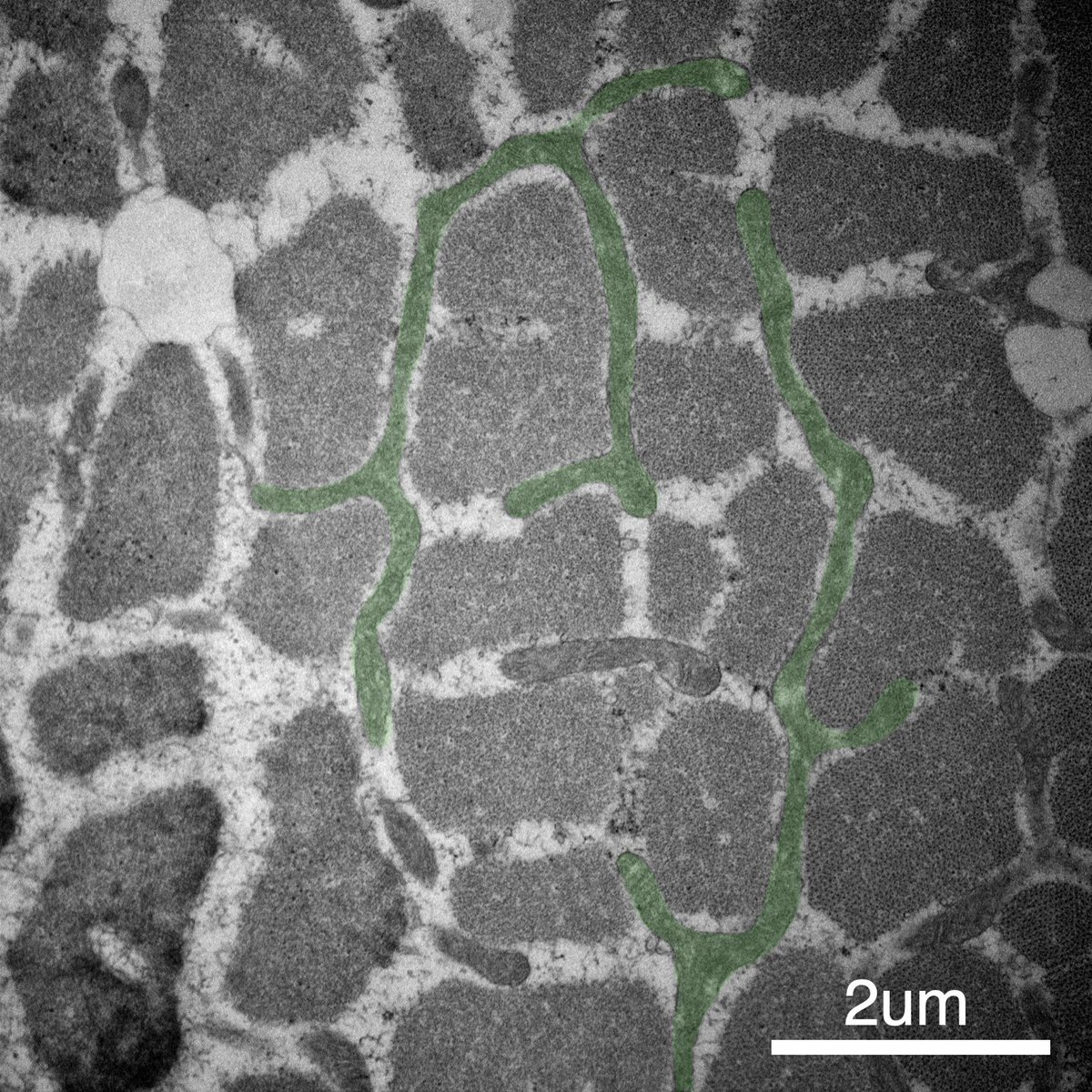 Martin Picard tweet media